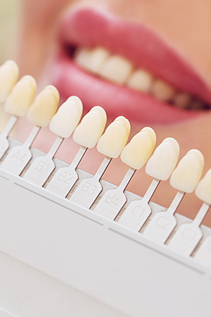 Отбеливание зубов Opalescence Boost: как это работает